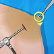 Operate Now Shoulder Surgery - Free  game