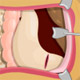Operate Now : Stomach Surgery Game